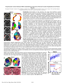 Using Dynamic Contrast Enhanced MRI to Quantitatively