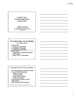 Large cell neuroendocrine carcinoma