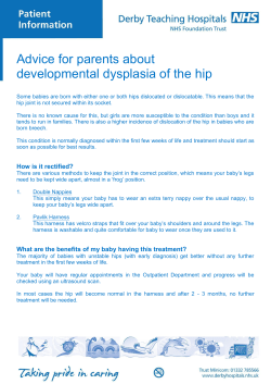 developmental dysplasia of the - Derby Teaching Hospitals NHS