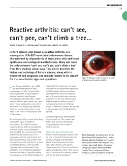 Reactive arthritis: can`t see, can`t pee, can`t climb a tree