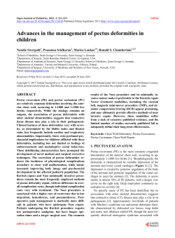 Advances in the management of pectus deformities in children