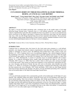 cutaneous horn on thigh following kangri thermal burns