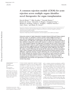 A common rejection module (CRM) for acute rejection across