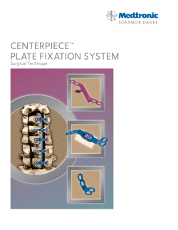 centerpiece&trade; plate fixation system