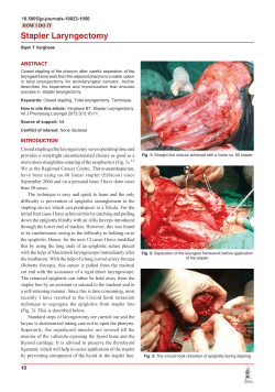 Stapler Laryngectomy