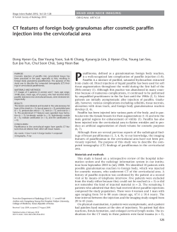 CT features of foreign body granulomas after cosmetic paraffin
