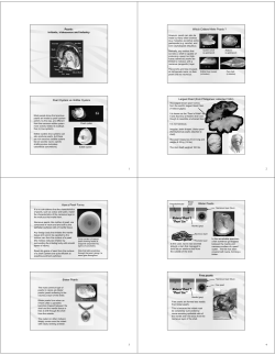 1 Pearls: irritants, iridescence and industry Pearl Oysters vs. Edible