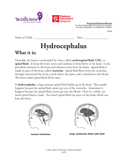 Hydrocephalus - Phoenix Children`s Hospital
