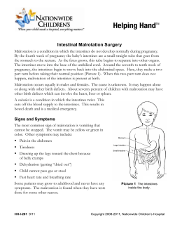 Intestinal Malrotation Surgery - Nationwide Children`s Hospital