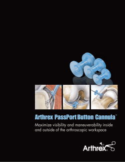 Arthrex PassPort Button Cannula&trade;