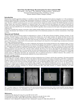 Real-Time Parallel Image Reconstruction for Interventional MRI
