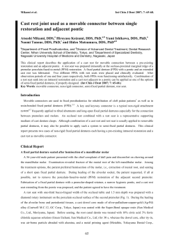 Cast rest joint used as a movable connector between single