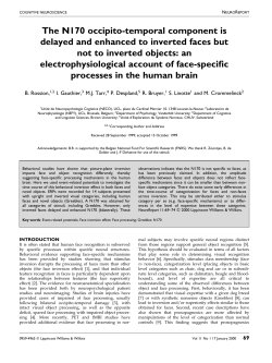 The N170 occipito-temporal component is delayed and enhanced to