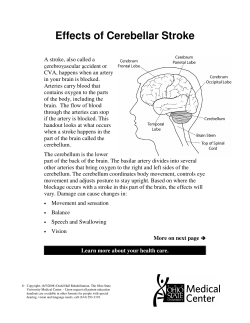 Effects of Cerebellar Stroke - Patient Education