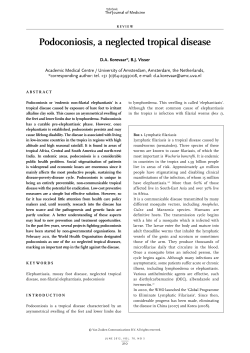Podoconiosis, a neglected tropical disease
