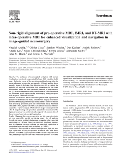 Non-rigid alignment of pre-operative MRI, fMRI, and DT