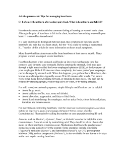 Tips for managing heartburn Q