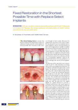 Fixed Restoration in the Shortest Possible Time with