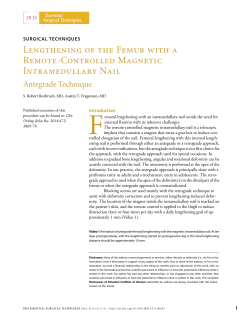 Lengthening of the Femur with a Remote