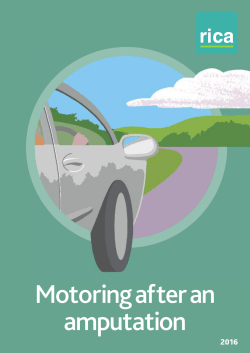 Motoring after an amputation