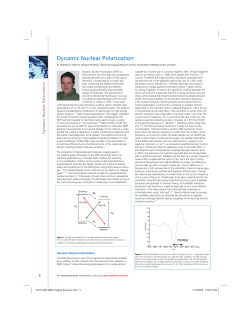 Dynamic Nuclear Polarization - Sigma