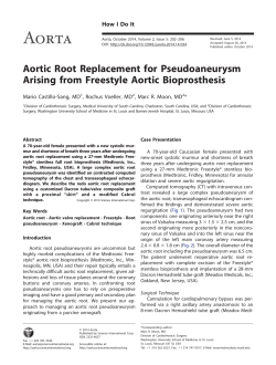 Aortic Root Replacement for Pseudoaneurysm Arising from