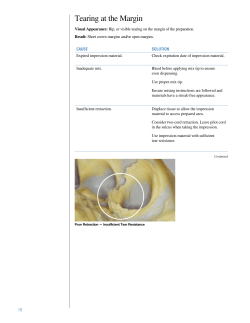 Tearing at the Margin - Dental Art Laboratories
