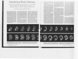 Simulating Brain Damage