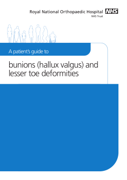 A Patient`s Guide To Bunions (Hallux Valgus)