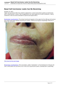 Basal Cell Carcinoma: Looks Can Be Deceiving