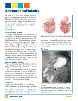 Malrotation and Volvulus