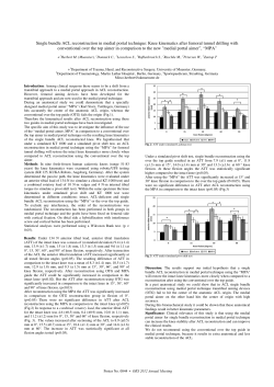 Single bundle ACL reconstruction in medial portal technique: Knee