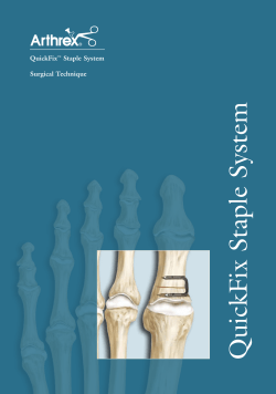 QuickFix&trade; Staple System