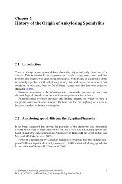 History of the Origin of Ankylosing Spondylitis