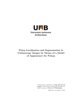 Polyp Localization and Segmentation in Colonoscopy Images by