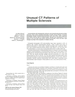 Unusual CT Patterns of Multiple Sclerosis