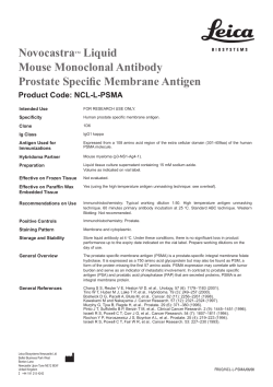 NovocastraTM Liquid Mouse Monoclonal Antibody Prostate Specific