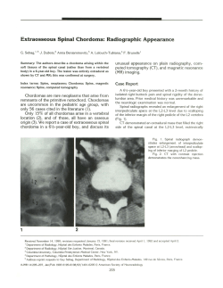 Extraosseous Spinal Chordoma: Radiographic Appearance