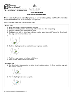How to use the Diaphragm - Planned Parenthood of Orange and