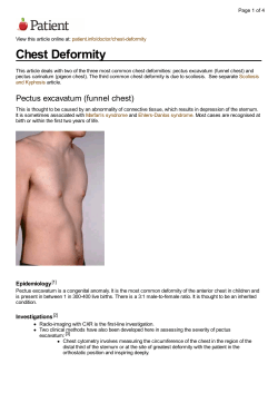 Chest Deformity