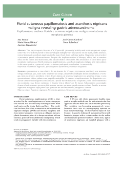 Florid cutaneous papillomatosis and acanthosis nigricans