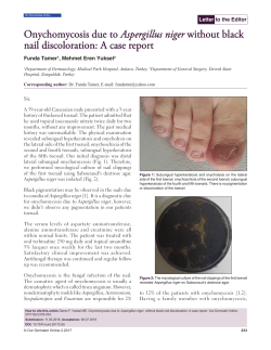 Onychomycosis due to Aspergillus niger without black nail