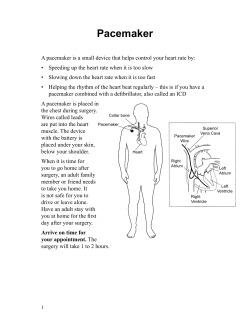 Pacemaker - Spanish - Health Information Translations