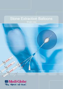 Stone Extraction Balloons
