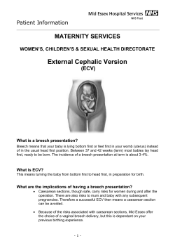 External Cephalic Version - Mid Essex Hospital Services NHS Trust
