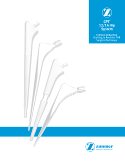 CPT&reg; 12/14 Hip System Femoral Impaction Grafting in