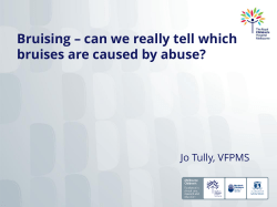 Bruising – can we really tell which bruises are caused by abuse?