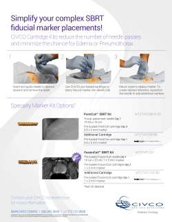 Simplify your complex SBRT fiducial marker placements!