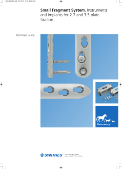 Small Fragment System. Instruments and implants for 2.7 and 3.5