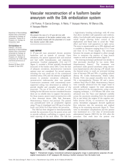 Vascular reconstruction of a fusiform basilar aneurysm
